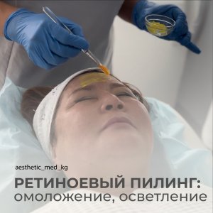 Ретиноевый (желтый) пилинг 