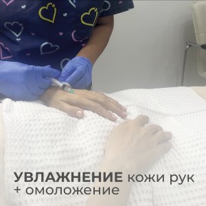 Биоревитализация для рук