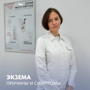 Экзема: Причины и Симптомы