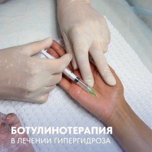 Ботулинотерапия в лечении гипергидроза ладоней!