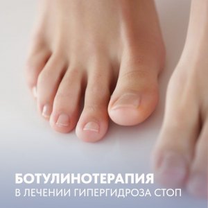 Ботулинотерапия в лечении гипергидроза стоп