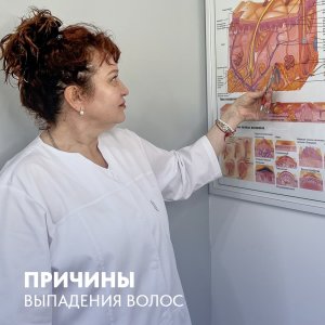 Причины выпадения волос