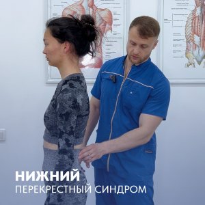 Нижний перекрестный синдром